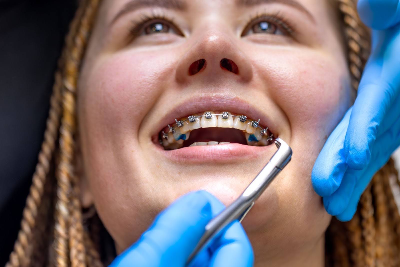 Orthodontics at Maple Dental Harrisburg